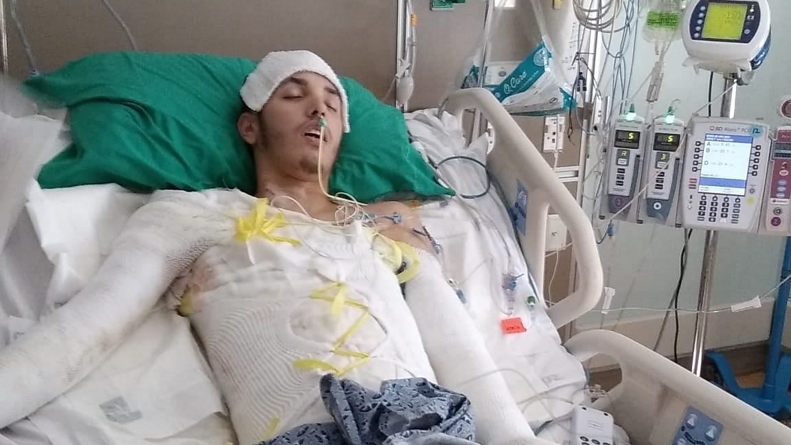 <div class="paragraphs"><p>Jean Baretto, a 26-year-old man from Florida, has spent at least 10 weeks in the hospital battling life-threatening burns.</p></div>