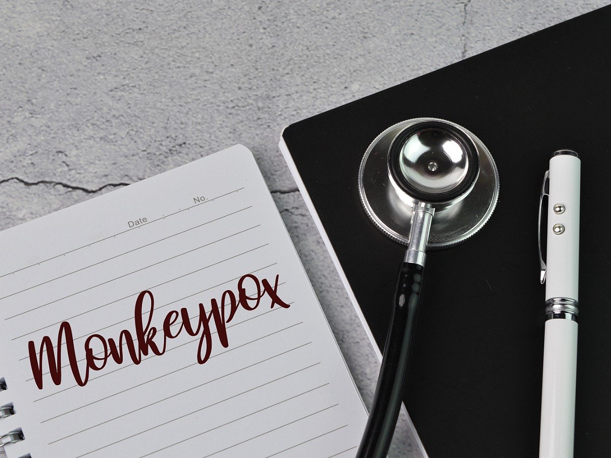 Monkeypox: Causes, Symptoms, Spread, Diagnosis, Prevention and Treatment - Vimarsana News
