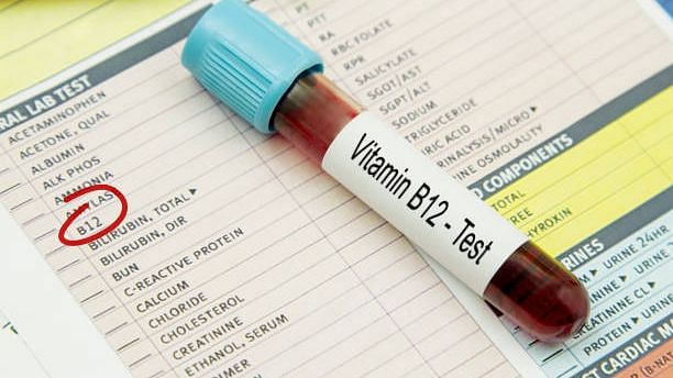 What are the best sources of vitamin B12? How do you know if you're deficient? 
