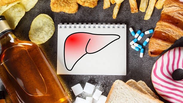 Fatty Liver: Why We As Indians, Need A Wake-up Call