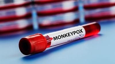 <div class="paragraphs"><p>India's first monkeypox patient has recovered from the virus. Image used for representational purposes.</p></div>