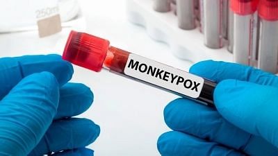 <div class="paragraphs"><p>Kerala reported it fifth monkeypox case on Tuesday, 2 August.</p></div>
