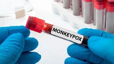 Centre Holds Meeting With Health Experts To Revisit Monkeypox Guidelines
