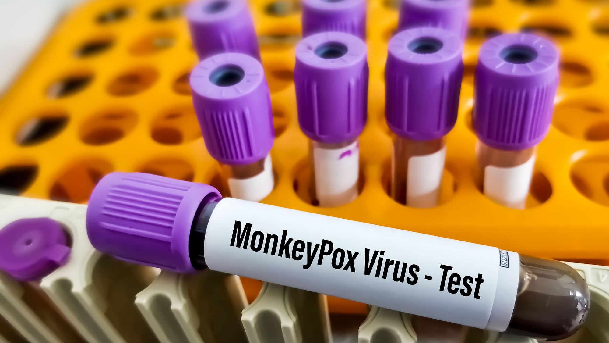 <div class="paragraphs"><p>A 35-year-old Nigerian man living in Delhi tested positive for monkeypox on Monday, 1 August. Image used for representational purposes.&nbsp;</p></div>