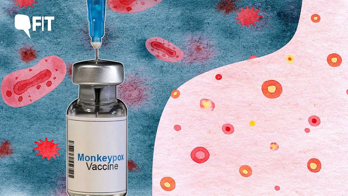 UK To Offer ‘Mini Doses’ of Monkeypox Vaccine to Combat Global Shortage