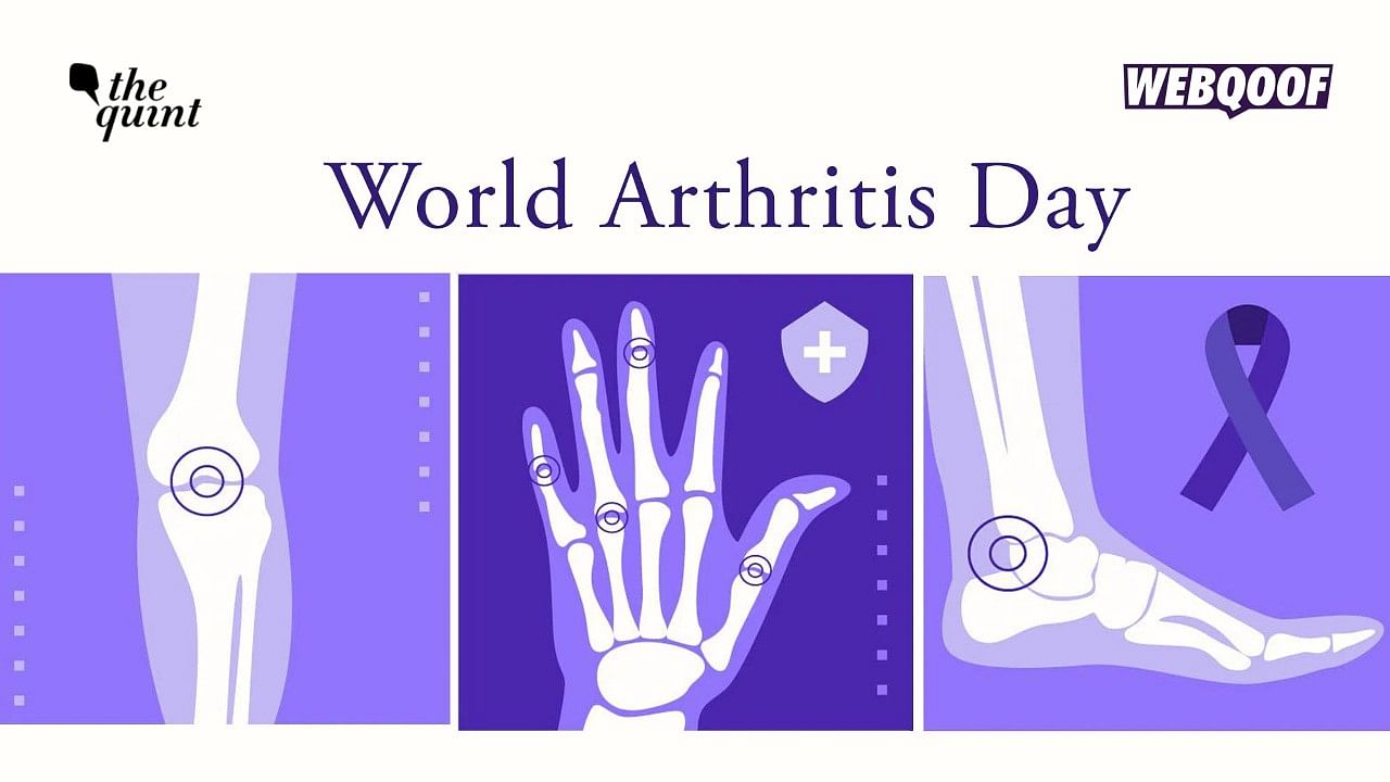 <div class="paragraphs"><p>World Arthritis Day 2022 debunking common myths.&nbsp;</p></div>