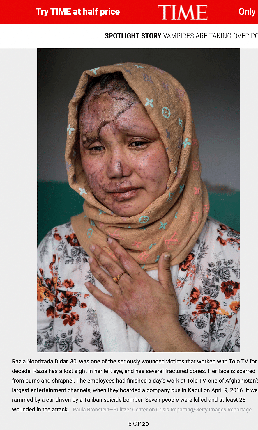 The photo is from 2016, and shows a woman who was severely injured in a suicide bombing attack on 20 January 2016.
