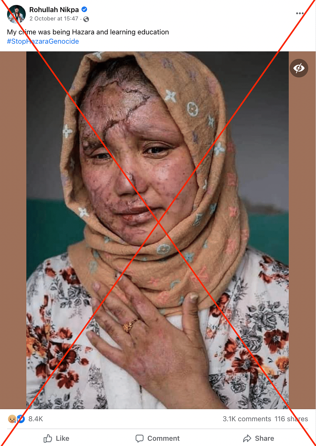 The photo is from 2016, and shows a woman who was severely injured in a suicide bombing attack on 20 January 2016.