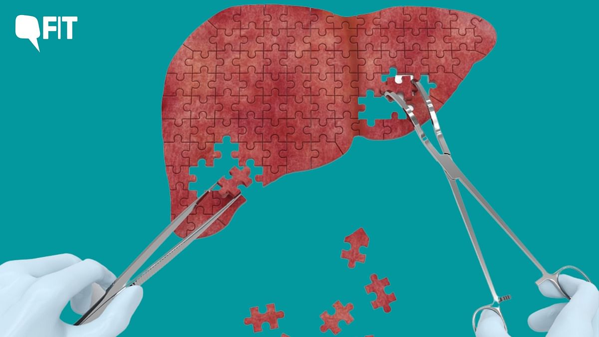 Leprosy Bacteria Triggers Liver Regeneration, Finds New Study: What We Know