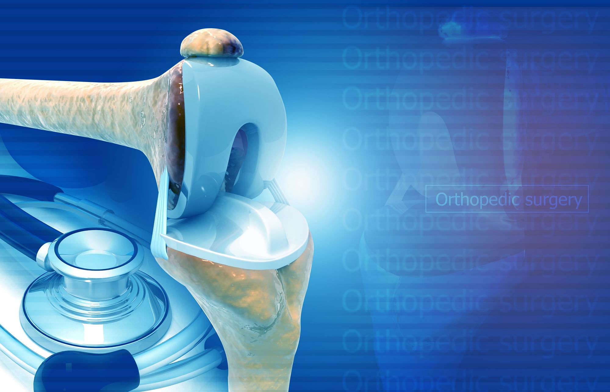 <div class="paragraphs"><p>How Orthoplus India Is Solving Ortho Implants Industry's Distribution Woes</p></div>