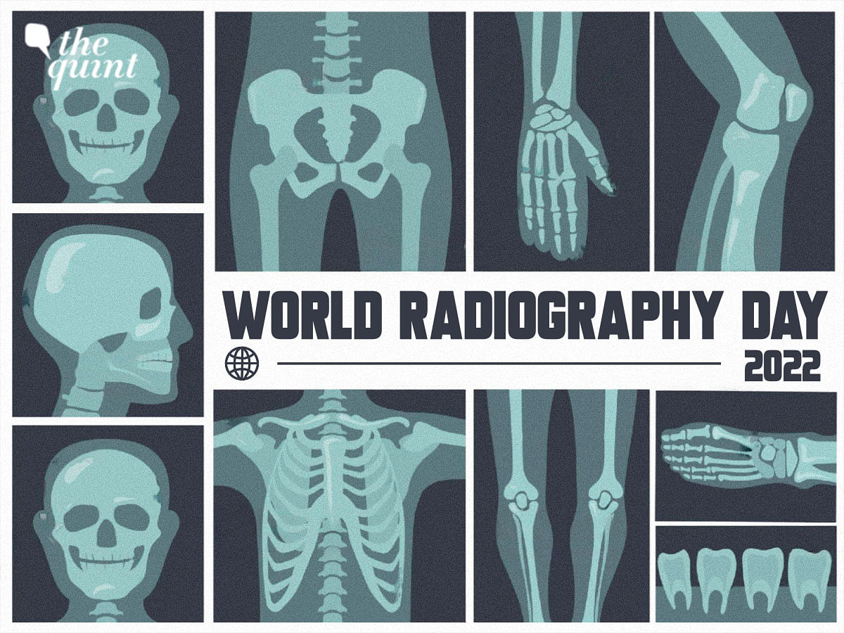 <div class="paragraphs"><p>Know about the history, significance, and theme of world Radiography day 2022</p></div>