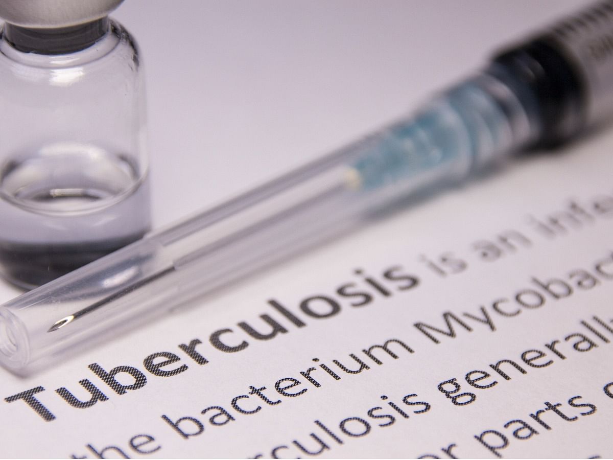Tuberculosis: Symptoms, Causes, Diagnosis, and Treatment