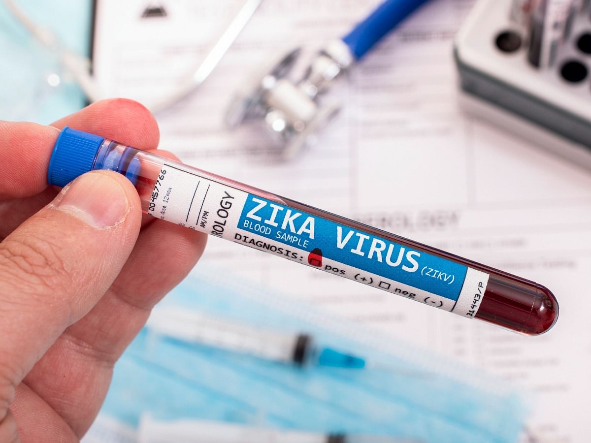 <div class="paragraphs"><p>Know about the causes, symptoms, diagnosis, and treatment of Zika virus.&nbsp;</p></div>