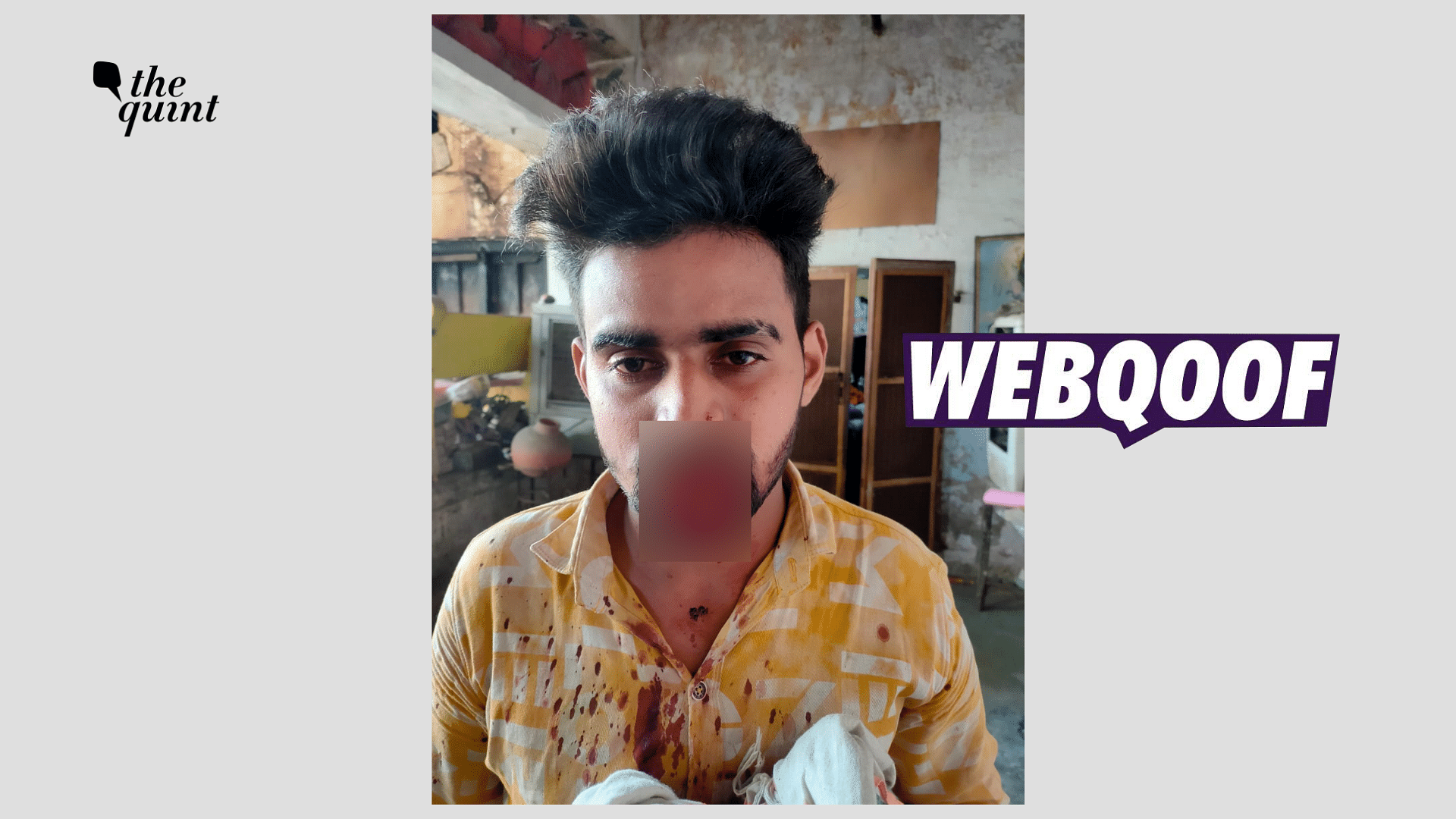 <div class="paragraphs"><p>The photo shows Mohit Saini, who was accused of attempting to rape a woman in Daurala in Uttar Pradesh's Meerut.</p></div>