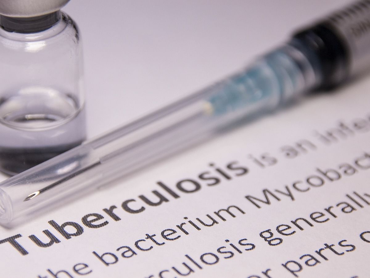 Busting Common Myths About Tuberculosis