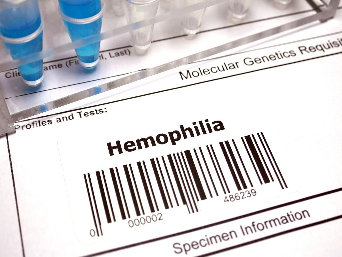 <div class="paragraphs"><p>World Hemophilia Day 2023: Know the Causes, Symptoms, Diagnosis, and Treatment</p></div>