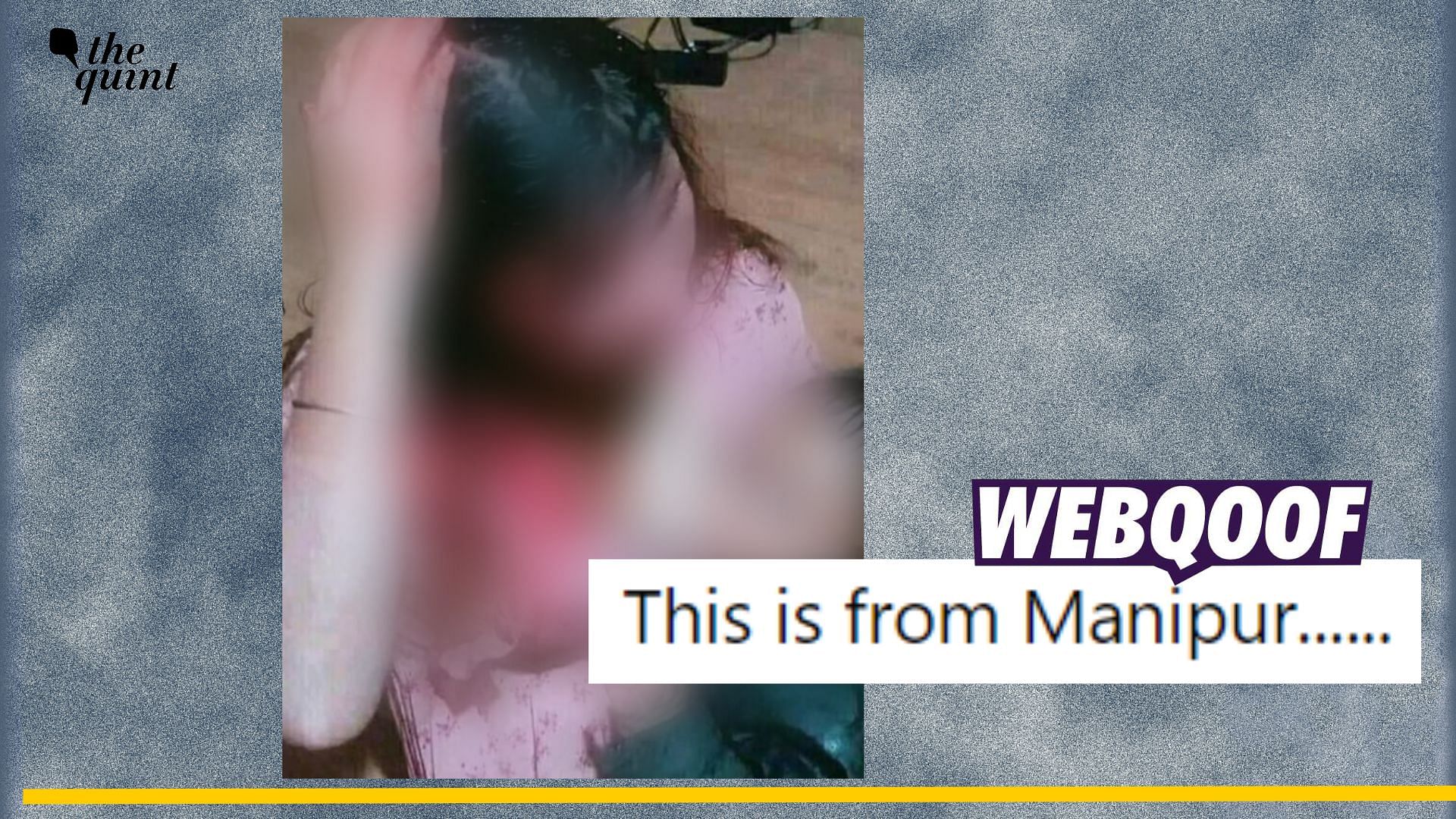 <div class="paragraphs"><p>Fact-check: This image of an injured woman is not from Manipur.</p></div>