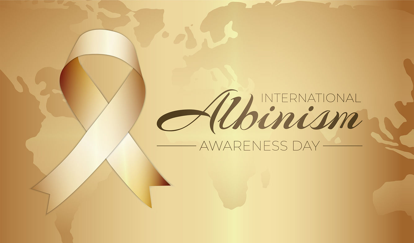 <div class="paragraphs"><p>International Albinism Awareness Day 2023: Here is everything you must know.</p></div>