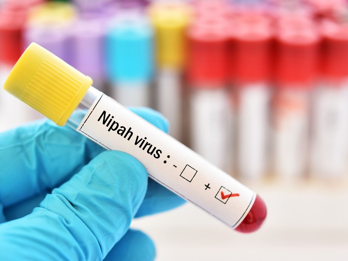 Nipah Virus Infection: Symptoms, Causes, Diagnosis, Treatment & More