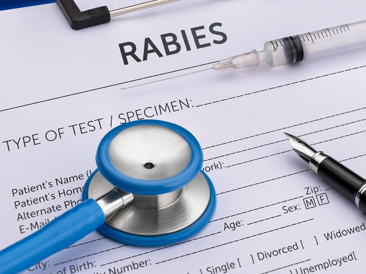 <div class="paragraphs"><p>Know the causes, symptoms, diagnosis and treatment for rabies</p></div>