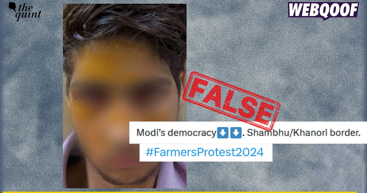 [The Quint]Image of Man's Face Covered With Pellet Wounds Isn't From 2024 Farmers' Protests