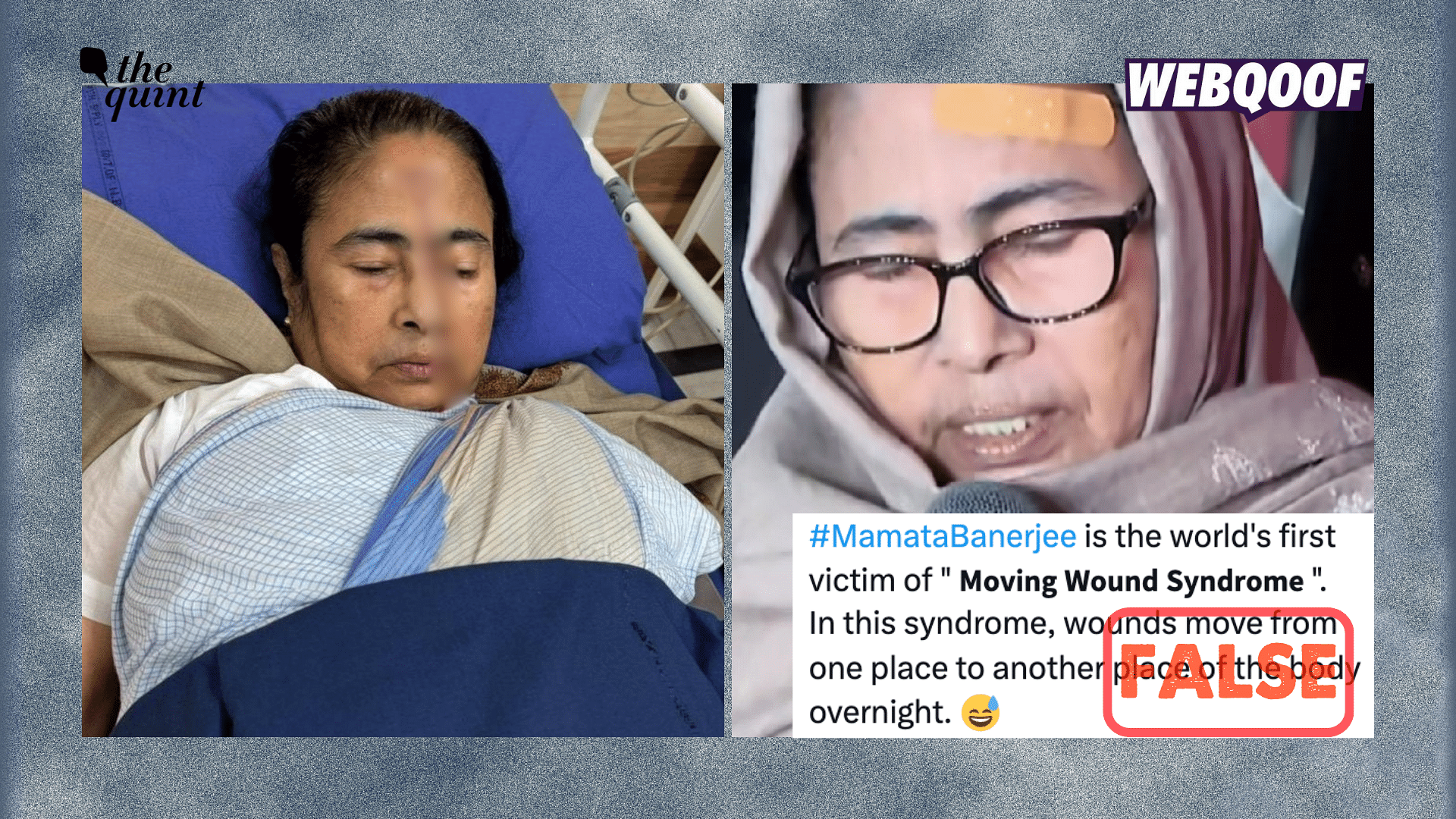 <div class="paragraphs"><p>The photos do not show West Bengal CM Mamata Banerjee faking her recent forehead injury.</p></div>