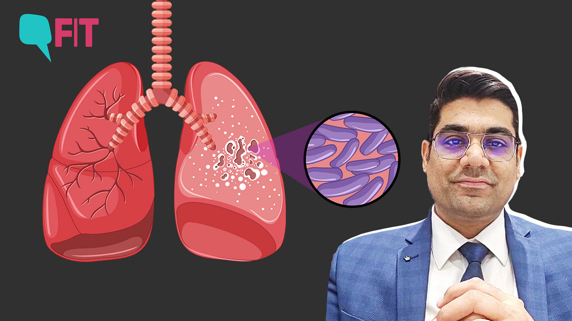 <div class="paragraphs"><p>On World Tuberculosis Day, Dr Vikas Oswal breaks down important points about the disease in a simple manner.</p></div>
