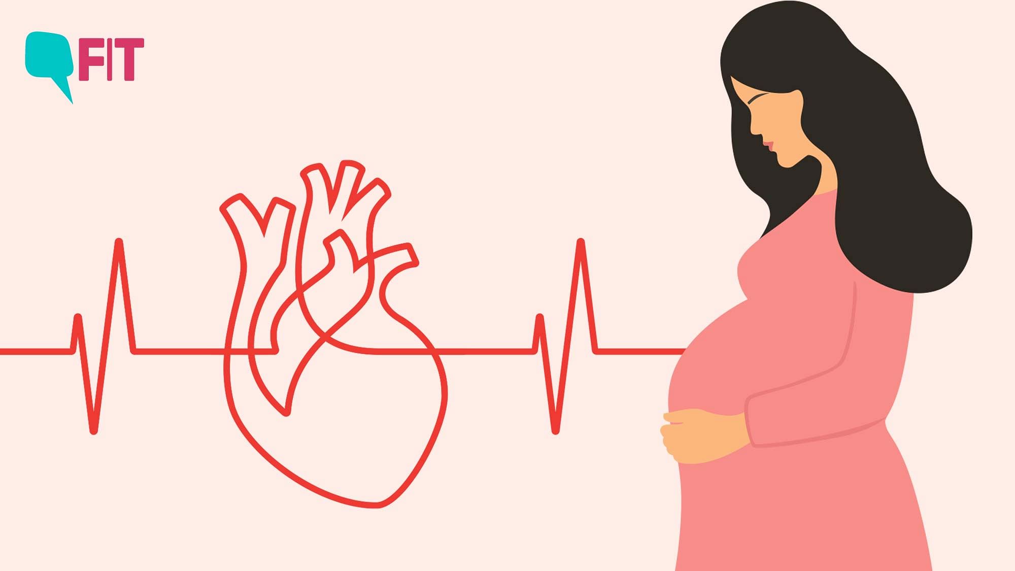 <div class="paragraphs"><p>The ICMR is conducting a study to find out the number of maternal deaths that happen due to cardiovascular diseases.</p></div>