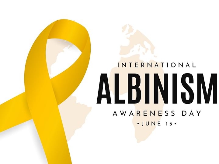 International Albinism Awareness Day 2024