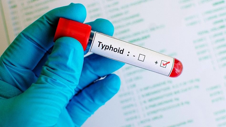 Currently, a third of the global population is at risk of typhoid fever.
