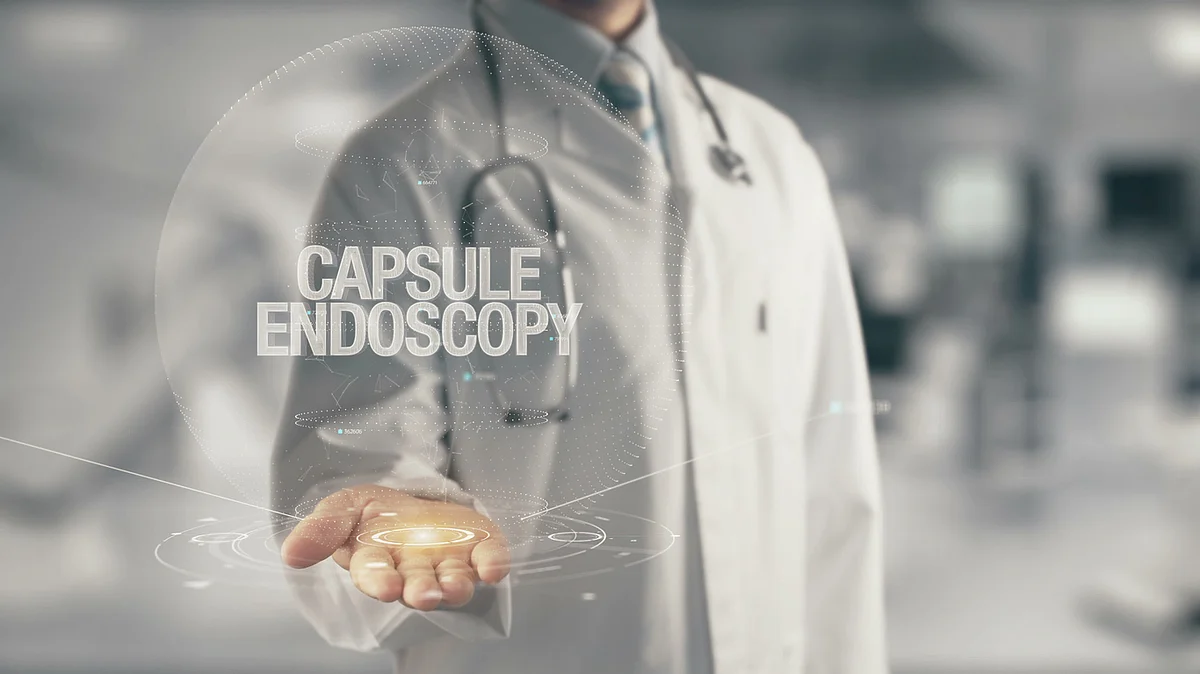 Capsule endoscopy is a procedure that uses a tiny wireless camera to take pictures of the digestive tract.