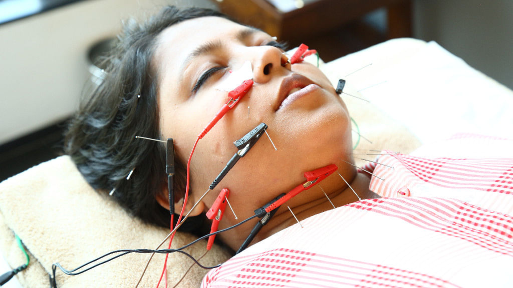 Cosmetic Acupuncture? I Put 100 Needles on My Face for Beauty 