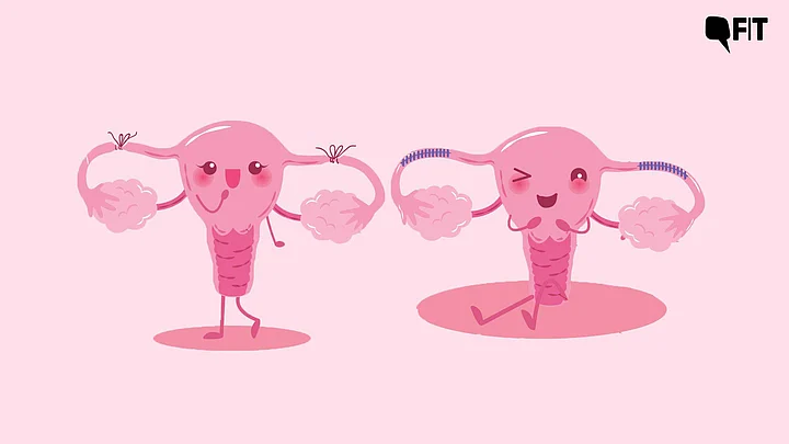 What Makes Female Sterilisation a Popular Method of Contraception?