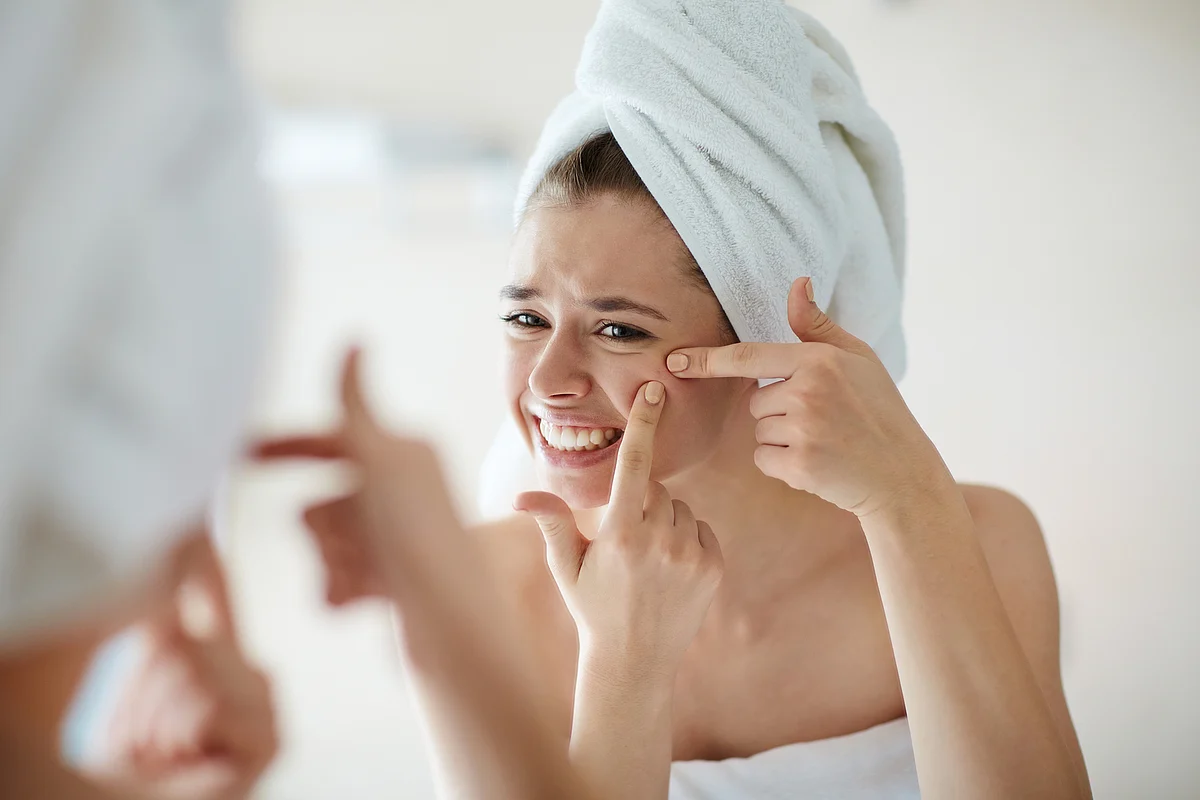 Let the acne and breakouts dry on their own.
