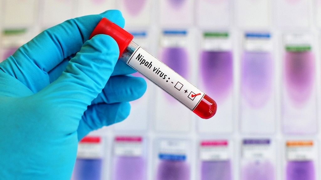 Nipah Virus Kerala 2019: A 23-year-old college student in Kerala has been confirmed to be infected with the Nipah virus.