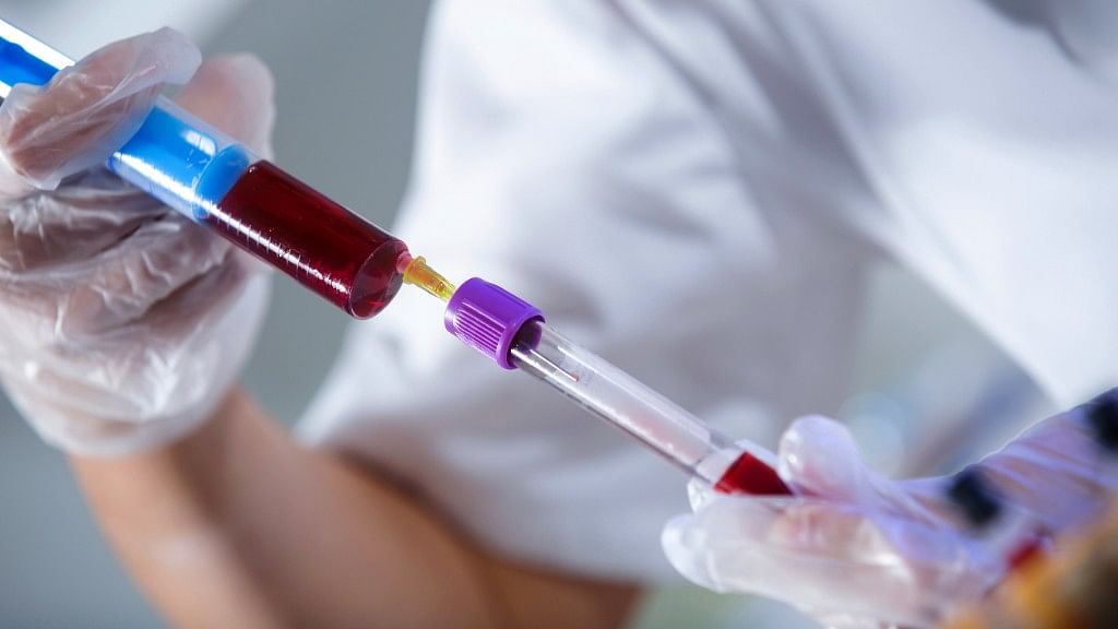A new research might convert type A blood into a universal donor.