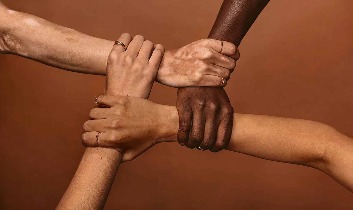Vitiligo: Foods to Eat and Avoid to Prevent Worsening of the Condition