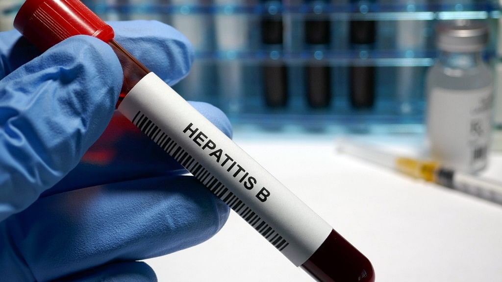A hepatitis B infection is far more likely to cause liver-related death than any of the other hepatic viruses. 