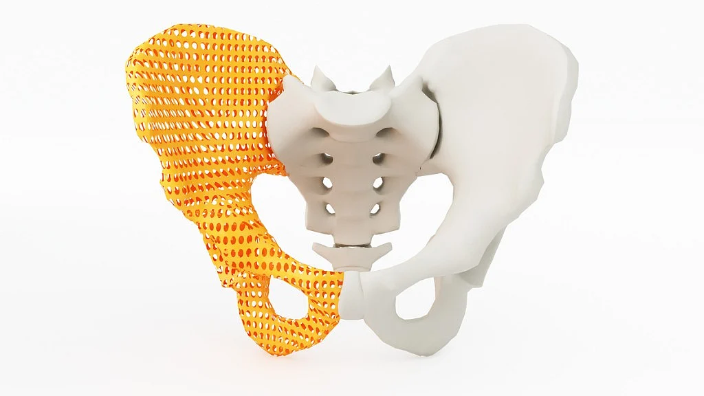 The Indian wing of Johnson & Johnson has been found to have hidden key facts about its faulty hip implants form the national regulatory body.