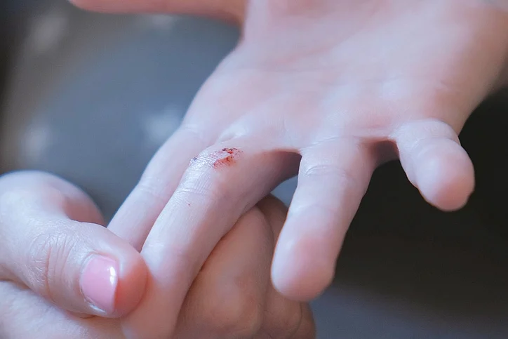 Use this simple DIY balm to sooth all insect and bug bites.