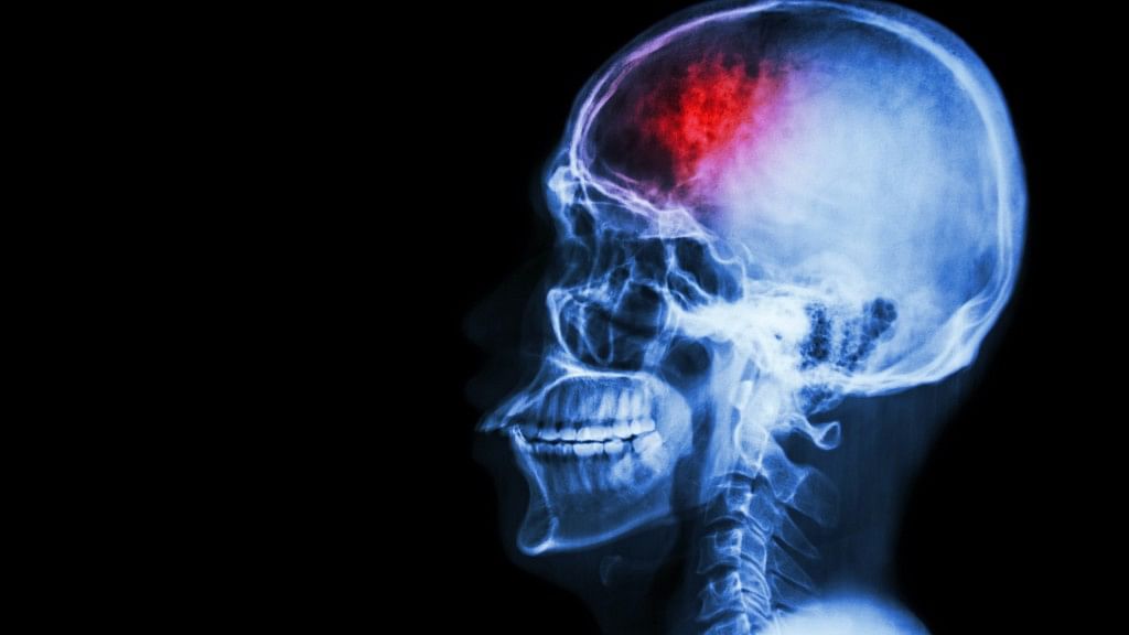 From nausea and dizziness to paralysis, all of these are symptoms of a stroke. Here’s how you address them.