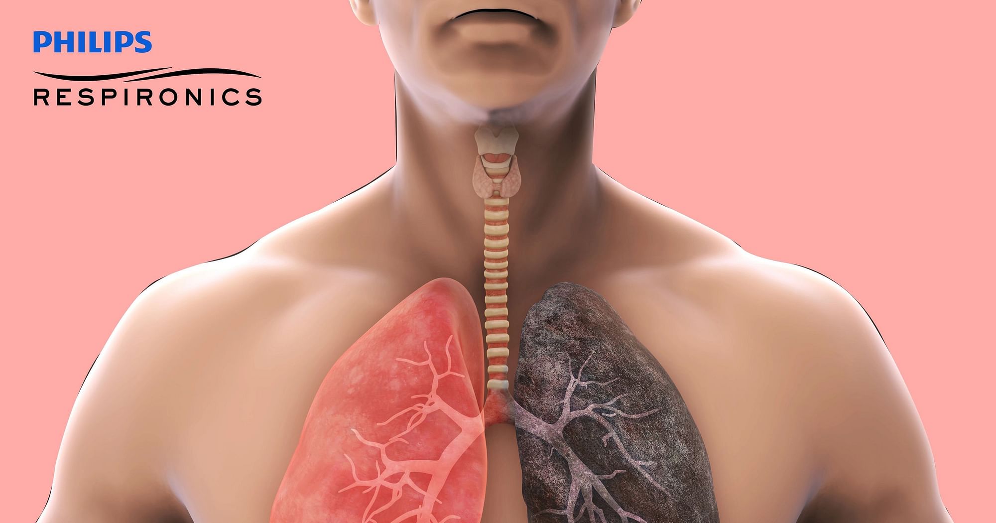 Chronic Obstructive Pulmonary Disease: Causes, Symptoms, Reasons to Get  Screened