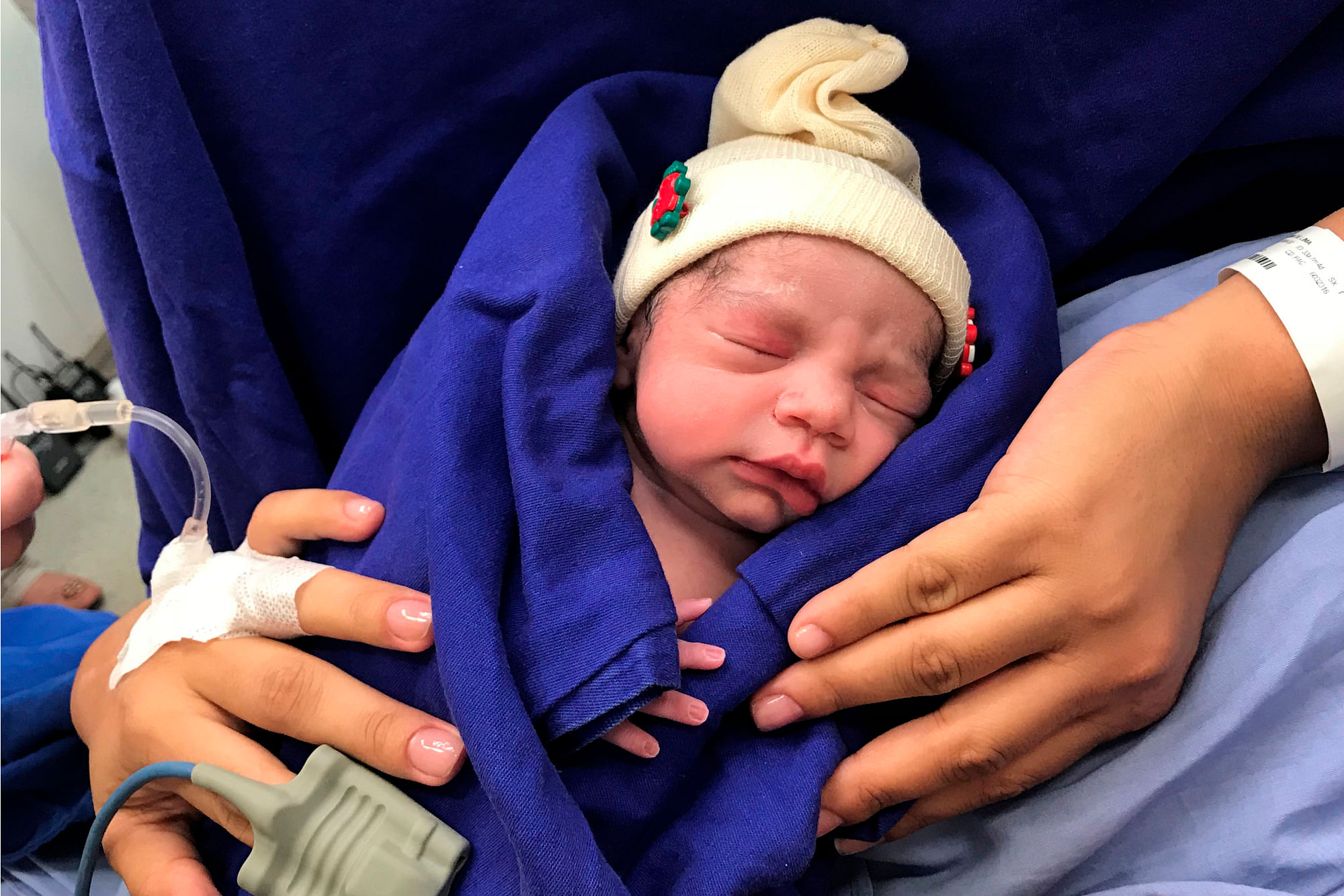 This Dec. 15, 2017 photo provided by transplant surgeon Dr. Wellington Andraus shows the baby girl born to a woman with a uterus transplanted from a deceased donor at the Hospital das Clinicas of the University of Sao Paulo School of Medicine, Sao Paulo, Brazil 