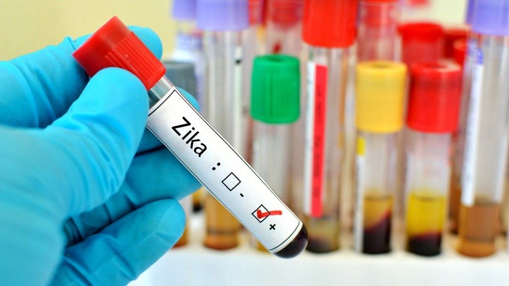 <div class="paragraphs"><p>For the first time, the presence of Zika virus has been confirmed in Kerala.</p></div>