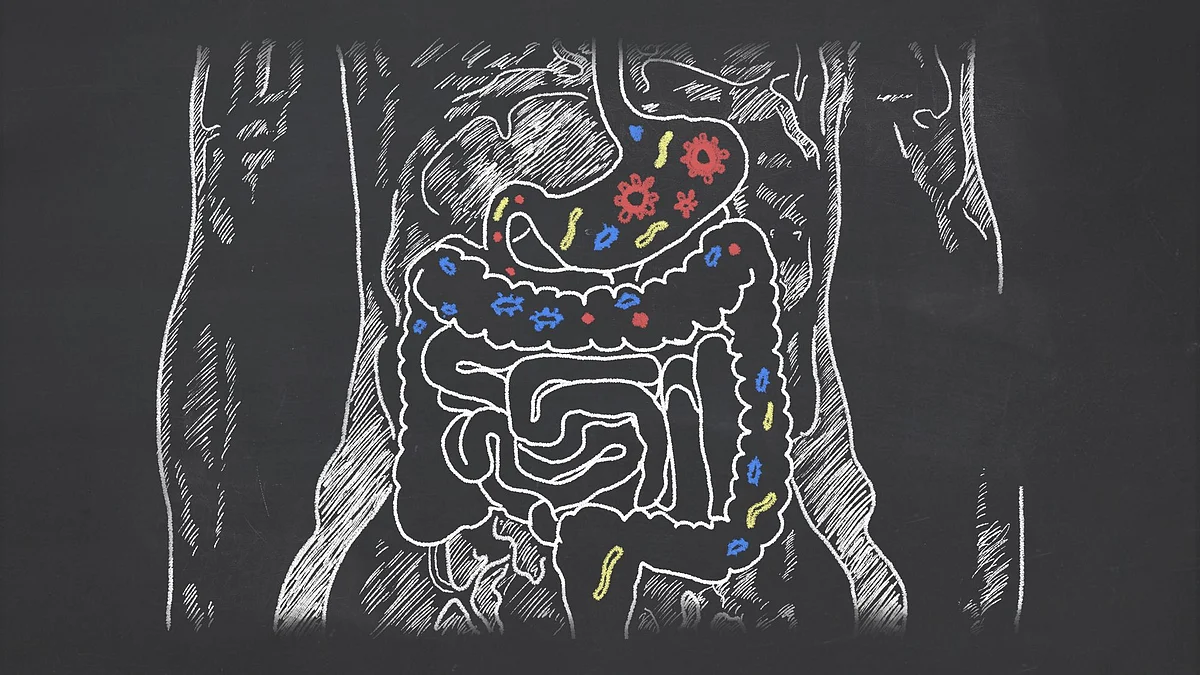 Cloves are good for digestion and stomach ulcers.