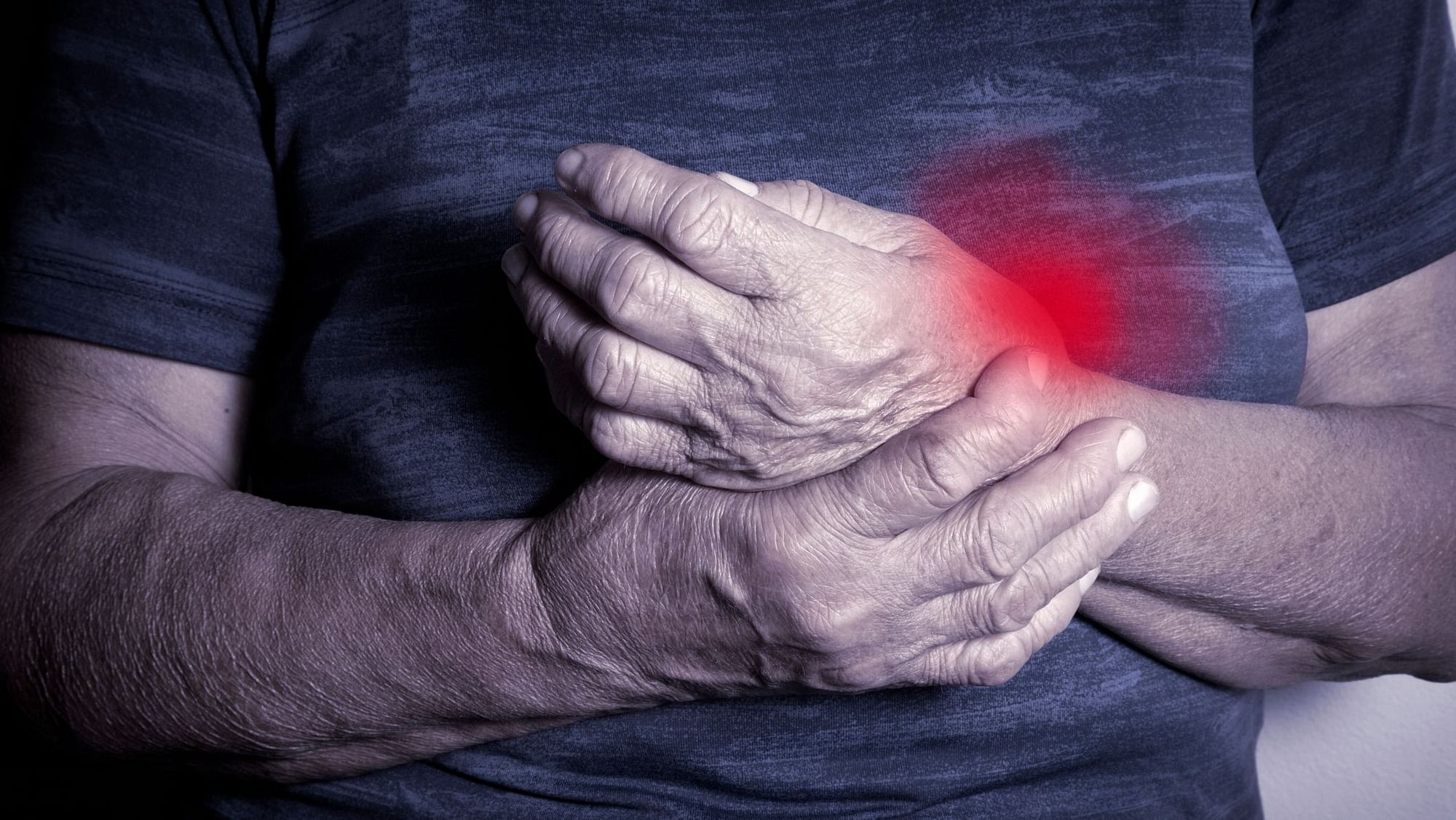 Symptoms of Rheumatoid Arthritis usually start between the ages of 40 and 60 years.