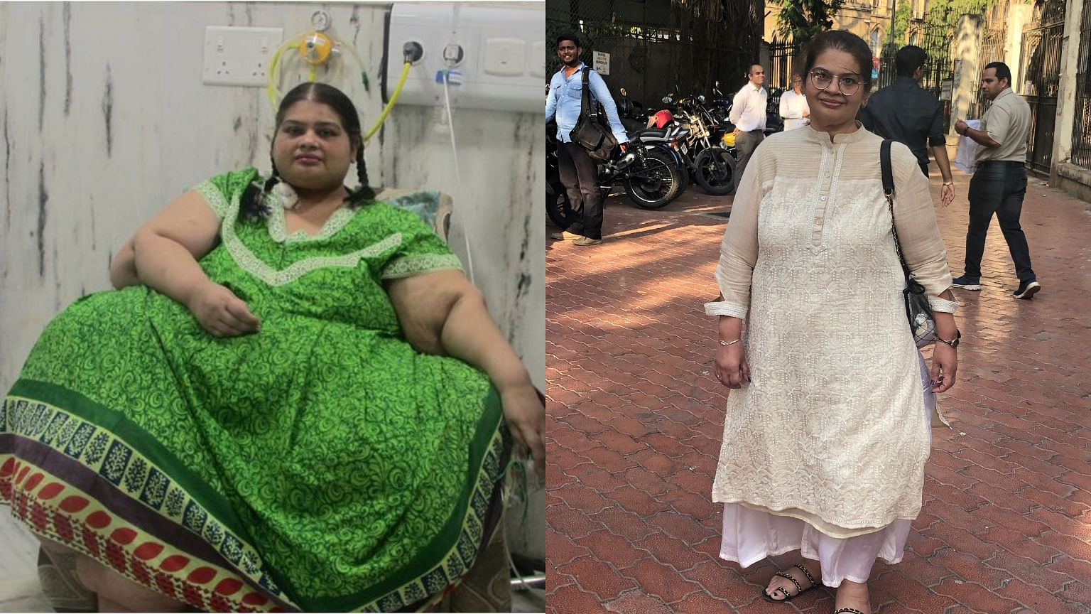 Amita Rajani pre and post her weight loss&nbsp;