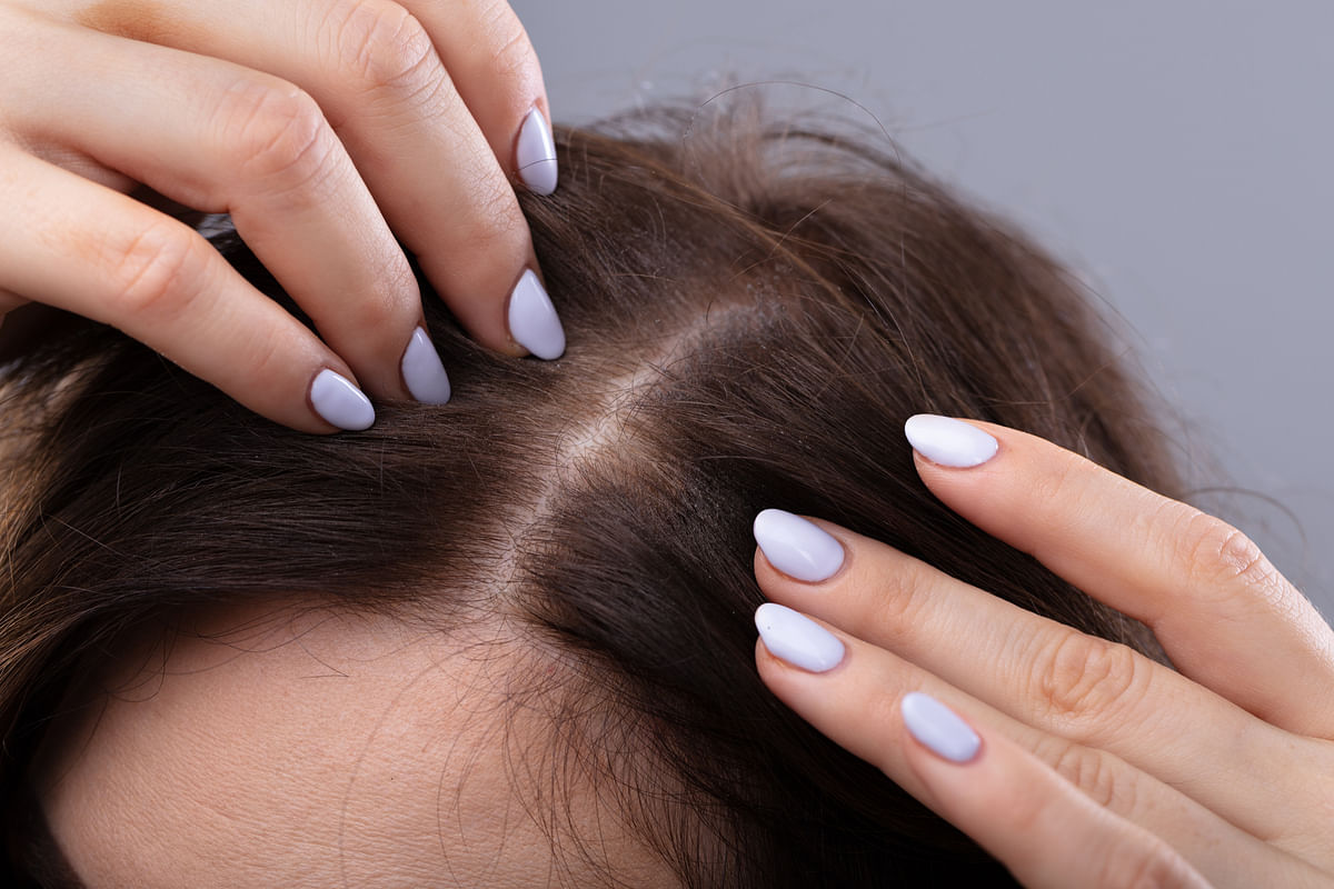 Struggling with Dandruff & Hair Loss? Try These Ayurvedic Remedies