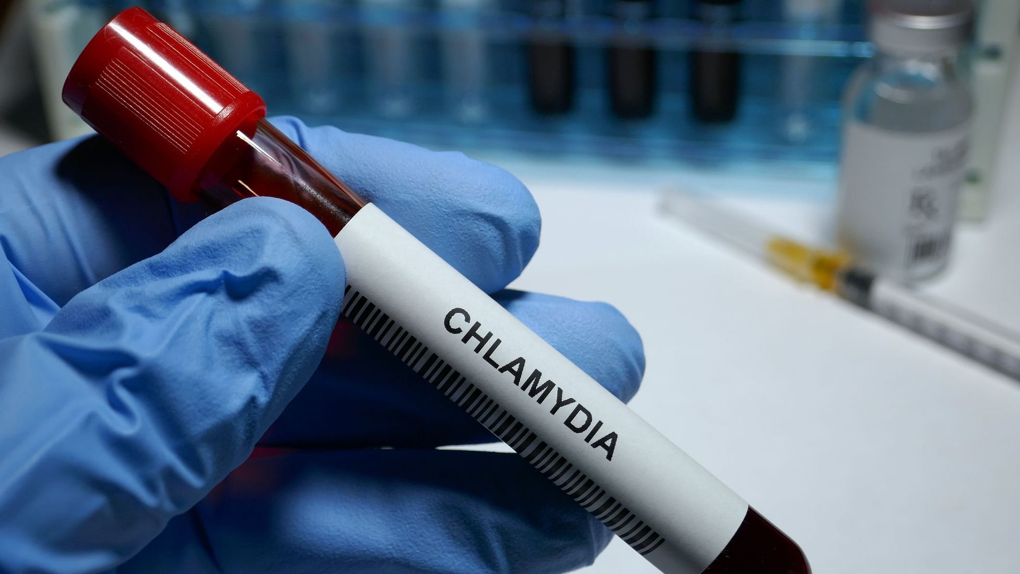 First chlamydia vaccine encouragingly triggered an immune response in women.