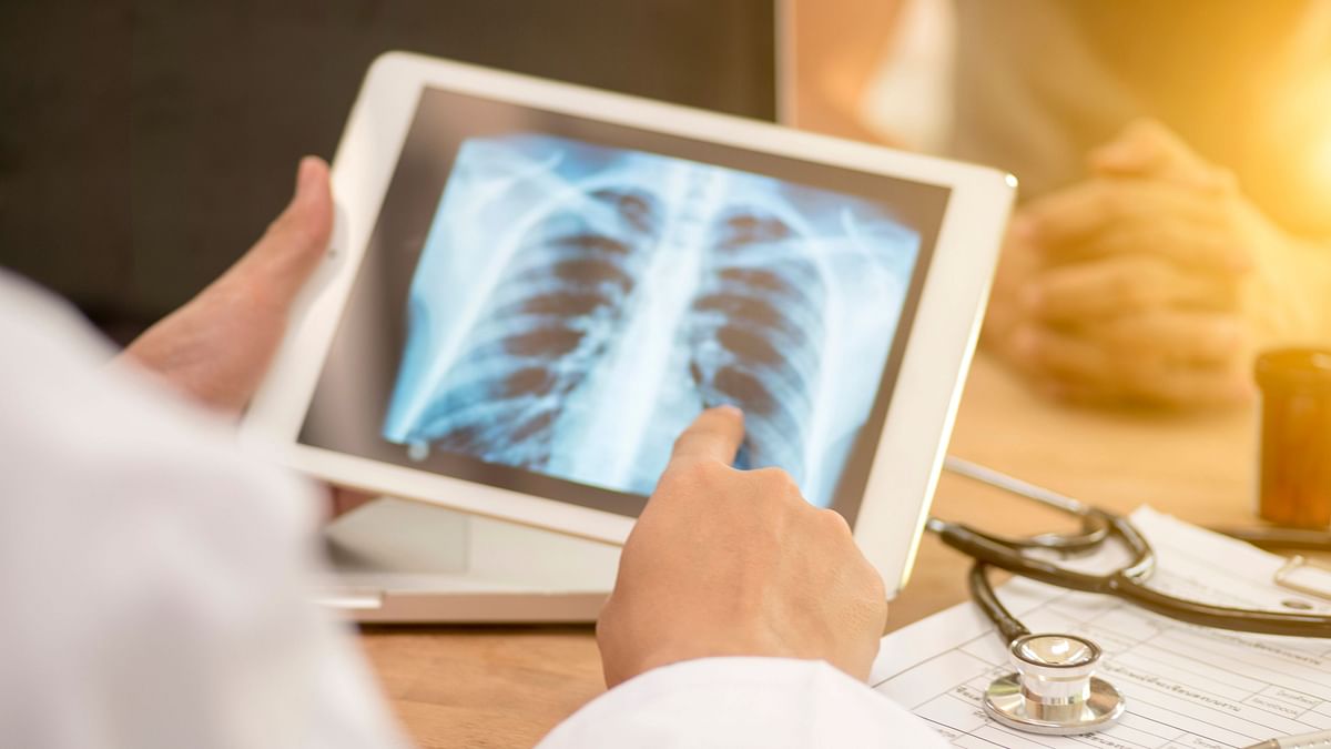 TB Survivors Are at Higher Risk of Developing Lasting Lung Damage